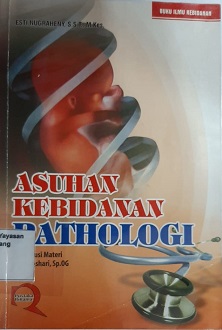klik untuk memperbesar gambar